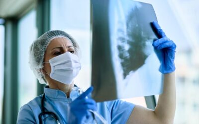 Post-Lung Surgery Care: 5 Key Tips for a Smooth and Successful Recovery