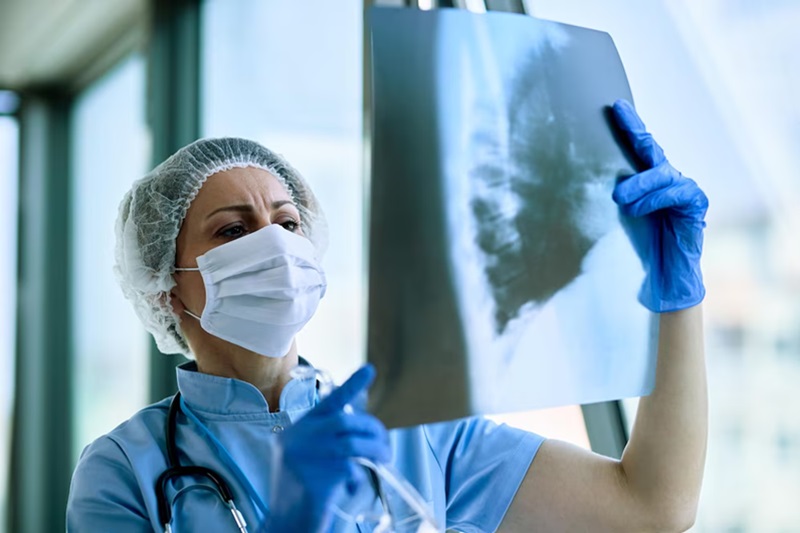 Post-Lung Surgery Care: 5 Key Tips for a Smooth and Successful Recovery