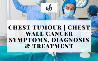 Chest tumour | Chest Wall Cancer Symptoms, Diagnosis & Treatment