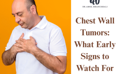 Chest Wall Tumors: What Early Signs to Watch For