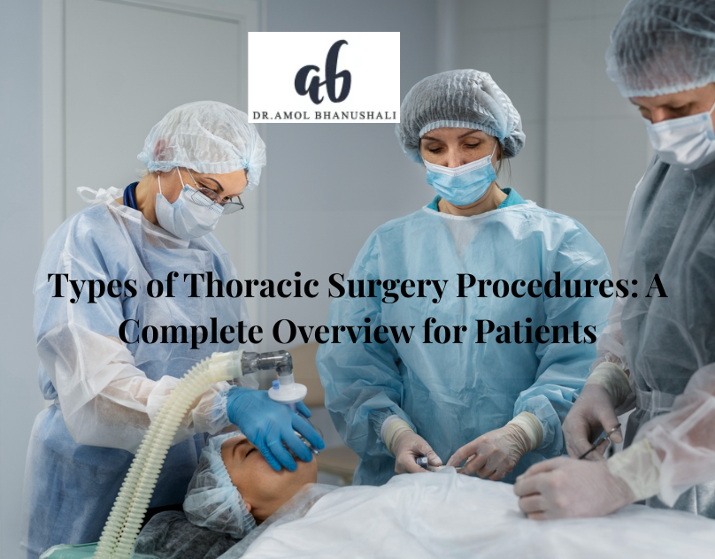 Types of Thoracic Surgery Procedures: A Complete Overview for Patients