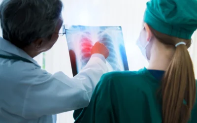 Is Thoracic Surgery the Only Way to Treat Lung Cancer – or Are There Other Options?
