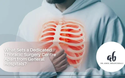 What Sets a Dedicated Thoracic Surgery Centre Apart from General Hospitals?