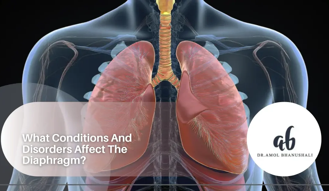 What Conditions And Disorders Affect The Diaphragm?