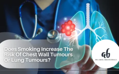 Does Smoking Increase The Risk Of Chest Wall Tumours Or Lung Tumours?