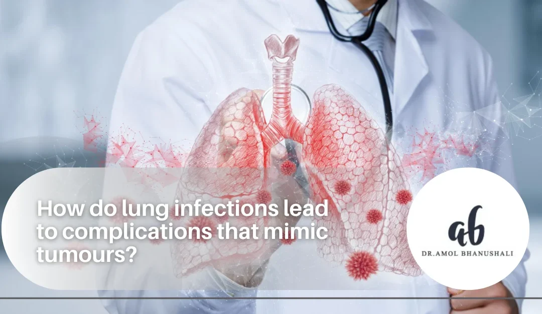 lung infection treatment