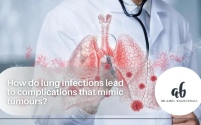 How do lung infections lead to complications that mimic tumours?