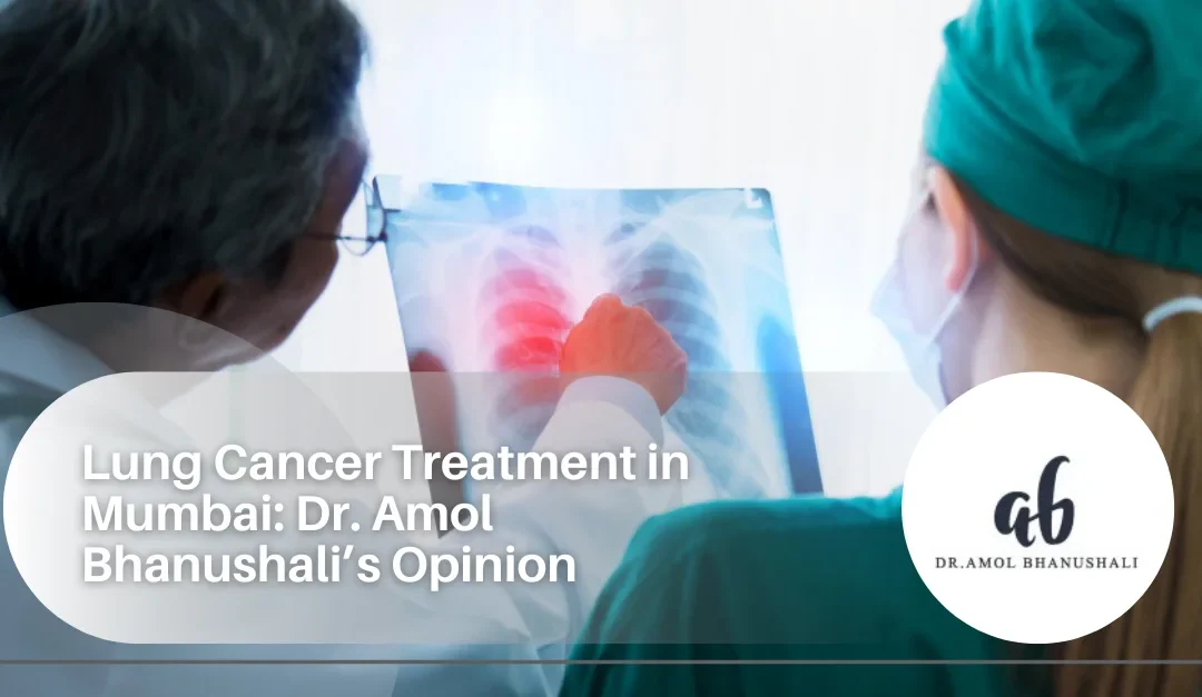 lung cancer treatment in Mumbai