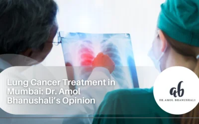 Lung Cancer Treatment in Mumbai: Dr. Amol Bhanushali’s Opinion