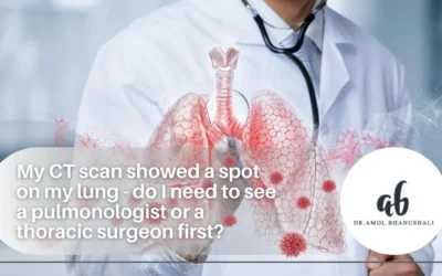 My CT scan showed a spot on my lung – do I need to see a pulmonologist or a thoracic surgeon first?