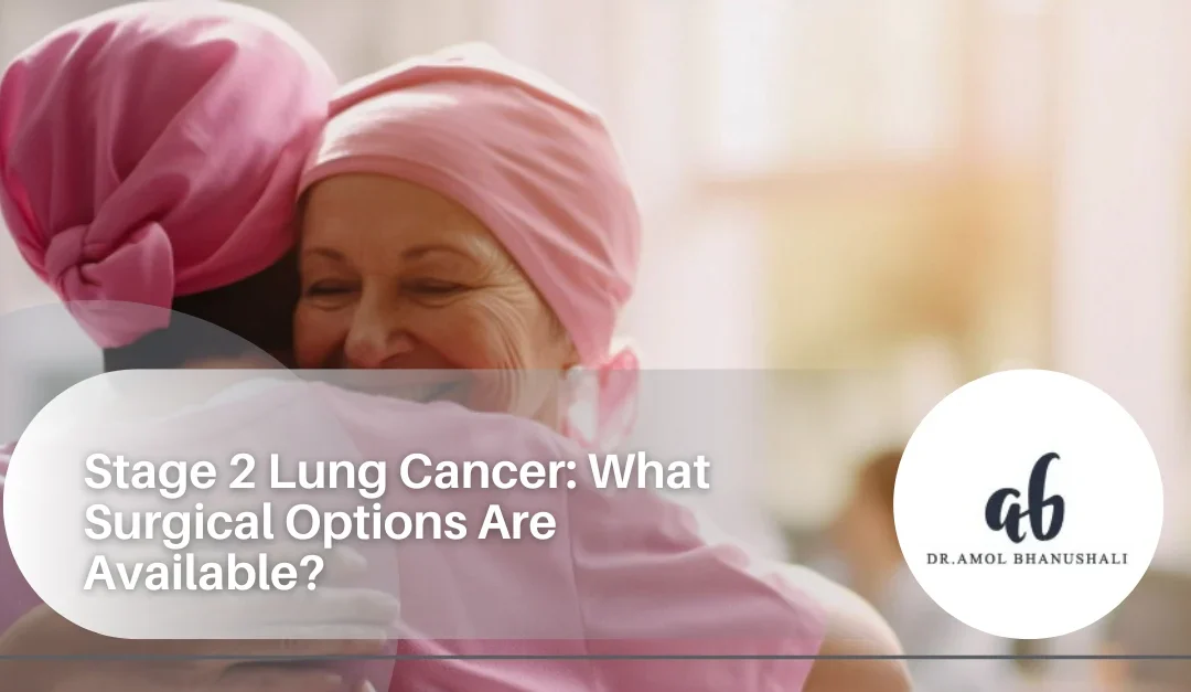 stage 2 lung cancer