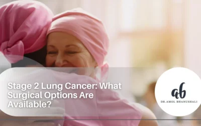 Stage 2 Lung Cancer: What Surgical Options Are Available?