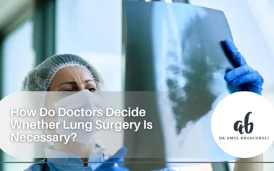 How Do Doctors Decide Whether Lung Surgery Is Necessary?