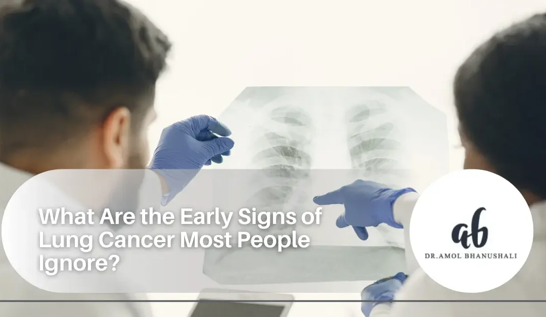 What Are the Early Signs of Lung Cancer Most People Ignore?
