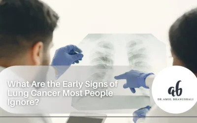 What Are the Early Signs of Lung Cancer Most People Ignore?