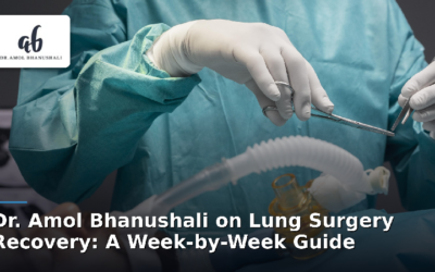 Lung Surgery Recovery: A Week-by-Week Guide