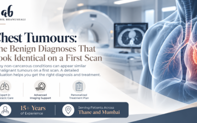 Chest Tumours: The Benign Diagnoses That Look Identical on a First Scan